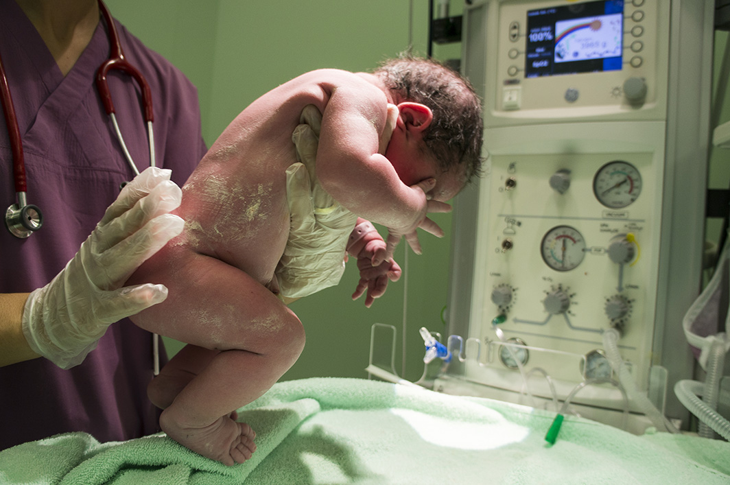 ٥ نصائح من ممرضة في قسم الولادة عن الولادة القيصرية