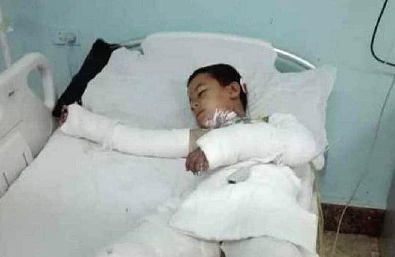 طفل مصري توفي متأثراً بحروق سببها التنمر