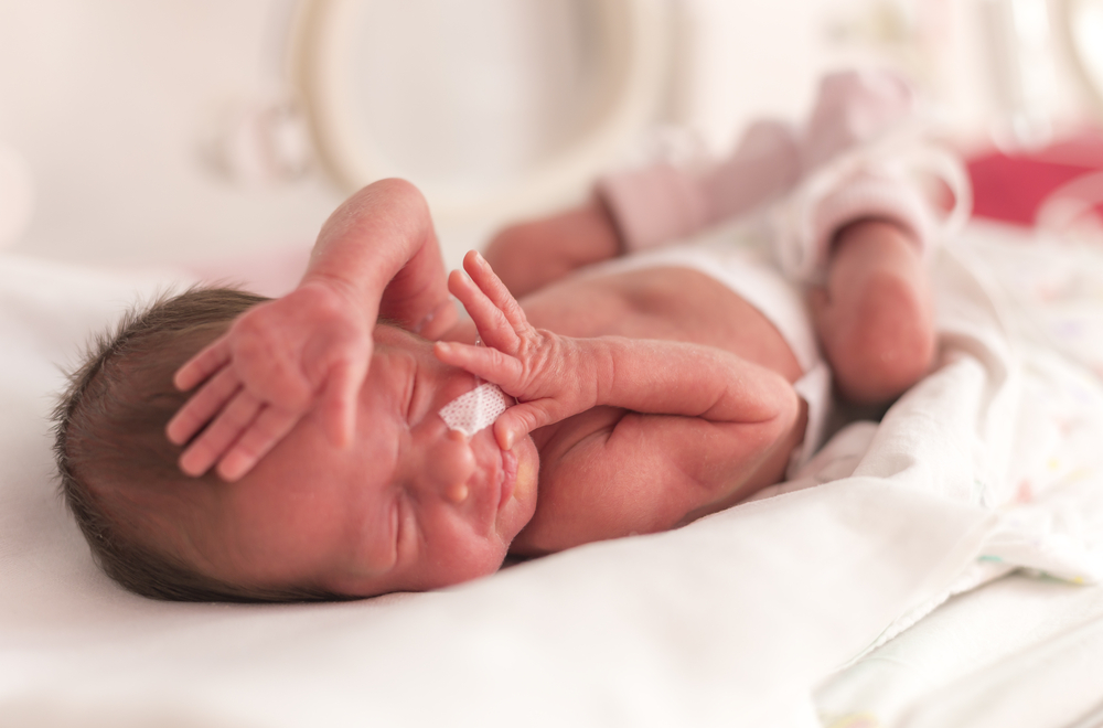 Preterm Delivery: Causes and Complications