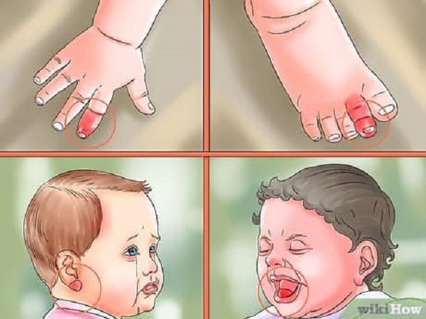 التفاف الشعر حول أصابع الطفل