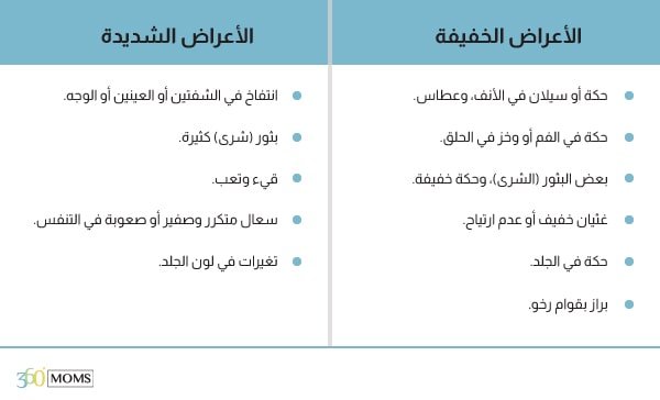 الأعراض الخفيفة والشديدة لحساسيات الطعام