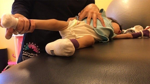 360moms- طفل من ذوي الاحتياجات يخضع لجلسات علاج طبيعي