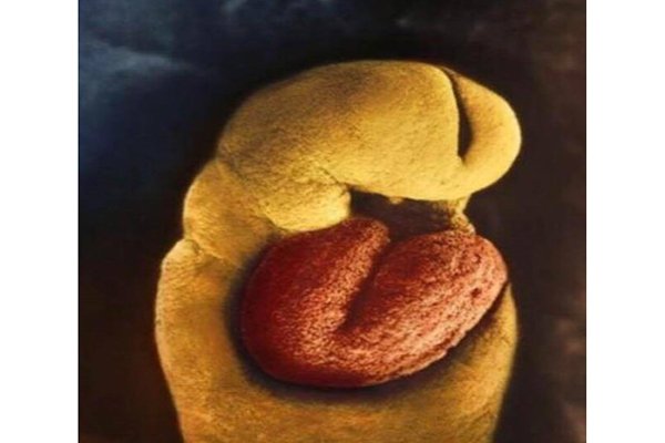تطور الجنين في الرحم