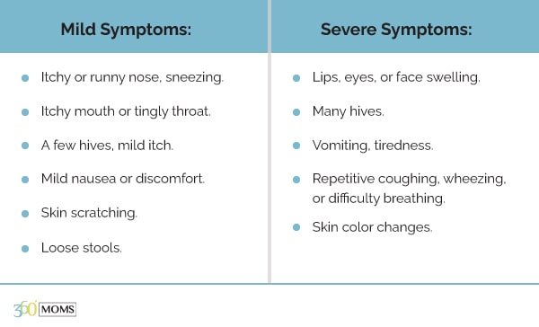 Severe and mild symptoms of food allergies